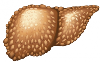 Первичный билиарный цирроз печени