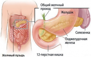 Холецистит симптомы и лечение