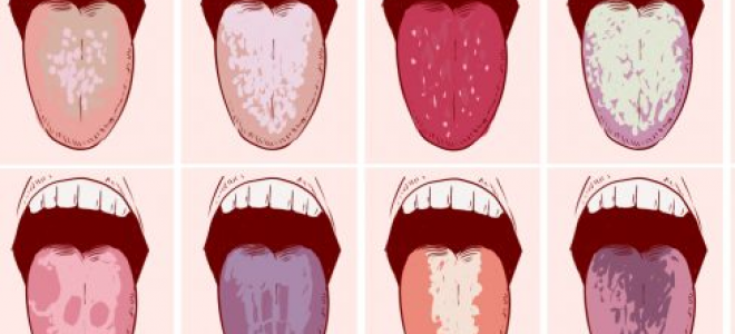 Как избавиться от кислого привкуса во рту