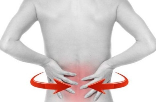 Опоясывающая боль в области спины