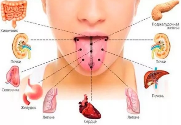 Запах изо рта причины лечение железа