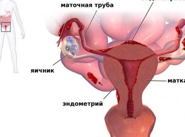 Во время менструации тянет внизу живота