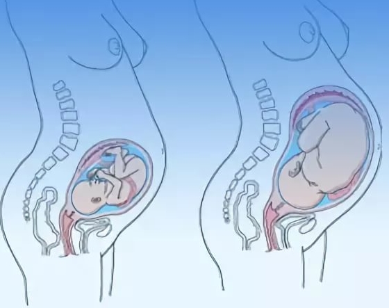Тошнит во время беременности в 3 триместре